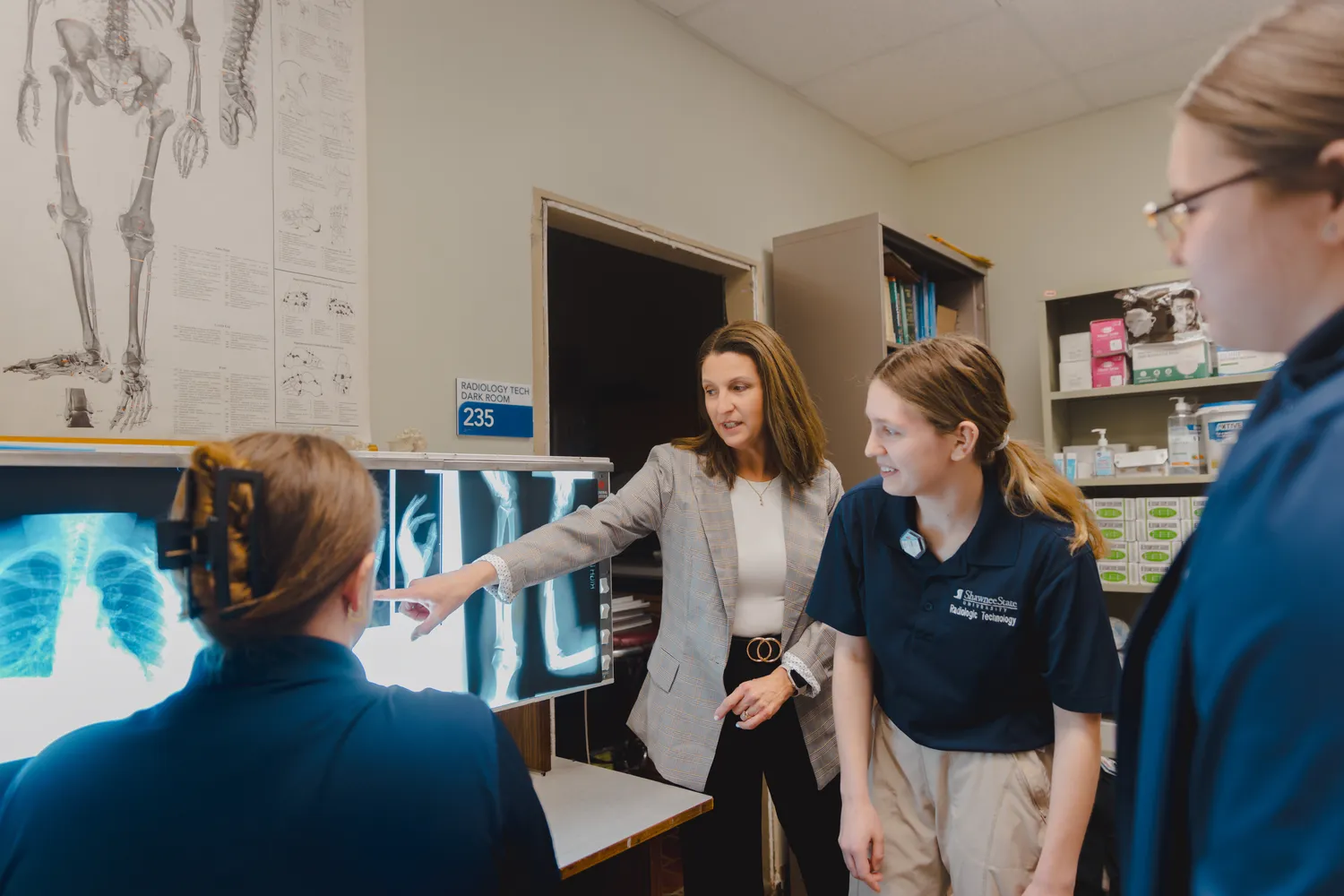 students looking at X ray image with professor